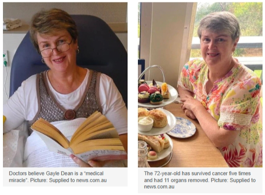 Medicinsko čudo: Žena pobijedila pet karcinoma i živi bez 11 organa